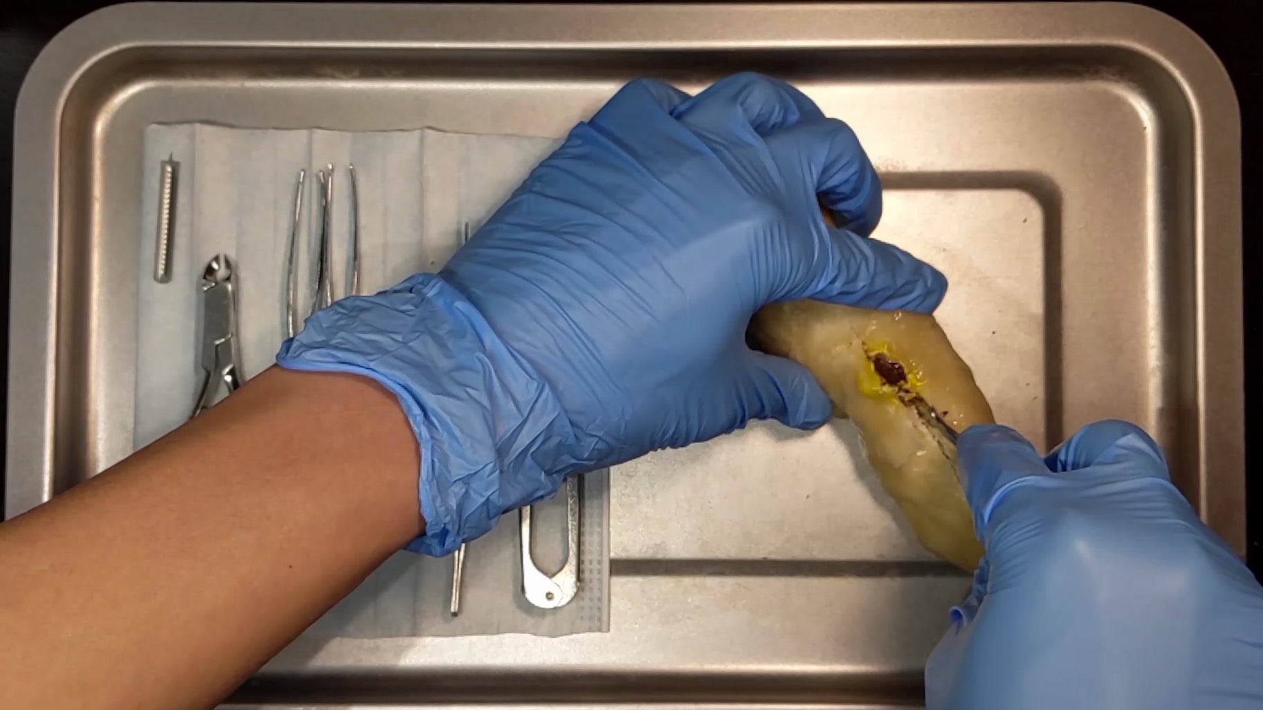A pair of hands wearing surgical gloves, trying to remove M&Ms embedded in steamed dough