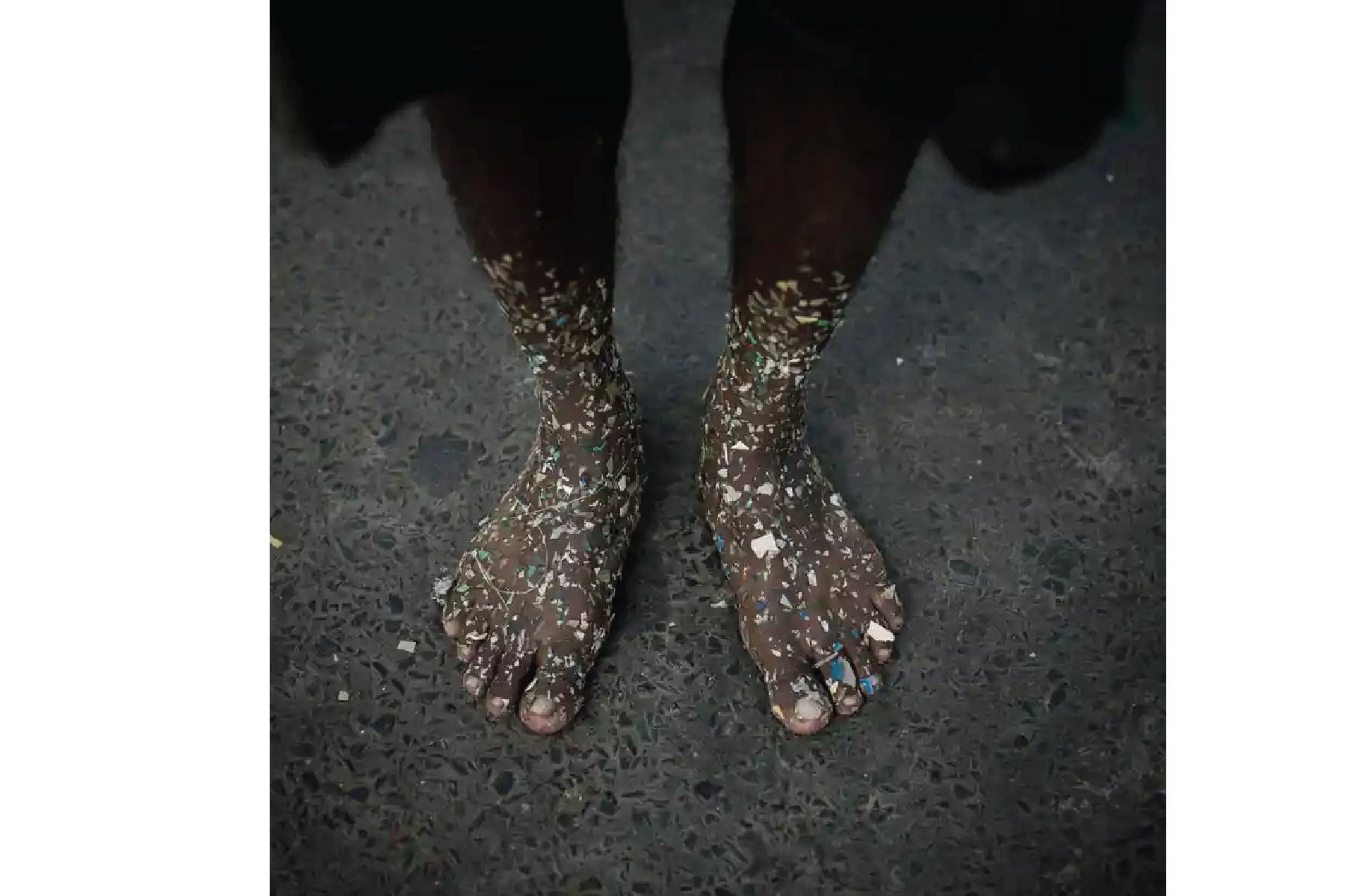 Plastic Personhood: Comodification of the body.