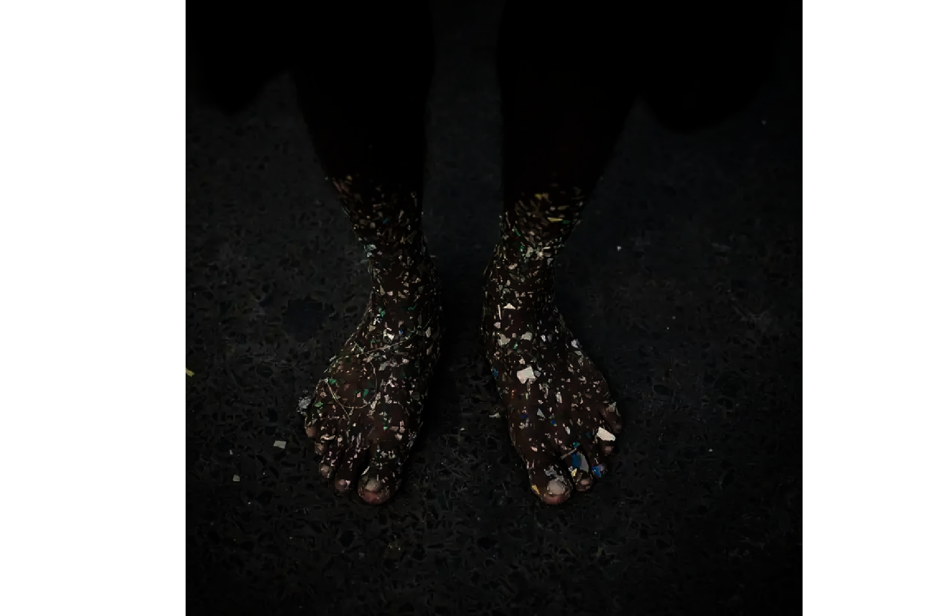 Plastic Personhood: Comodification of the body.