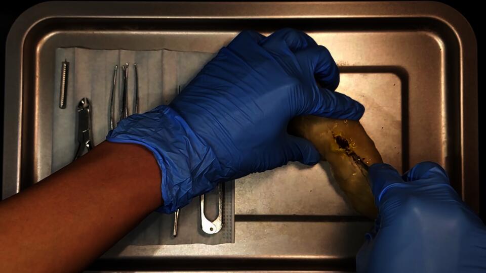 A pair of hands wearing surgical gloves, trying to remove M&Ms embedded in steamed dough