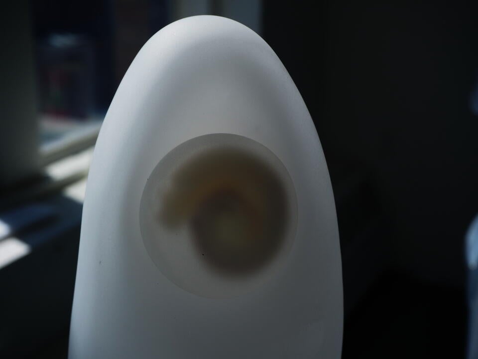 A white rice grain containing an embryo that evokes the shape of a human or animal.